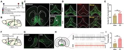 VTA-NAc glutaminergic projection involves in the regulation of pain and pain-related anxiety